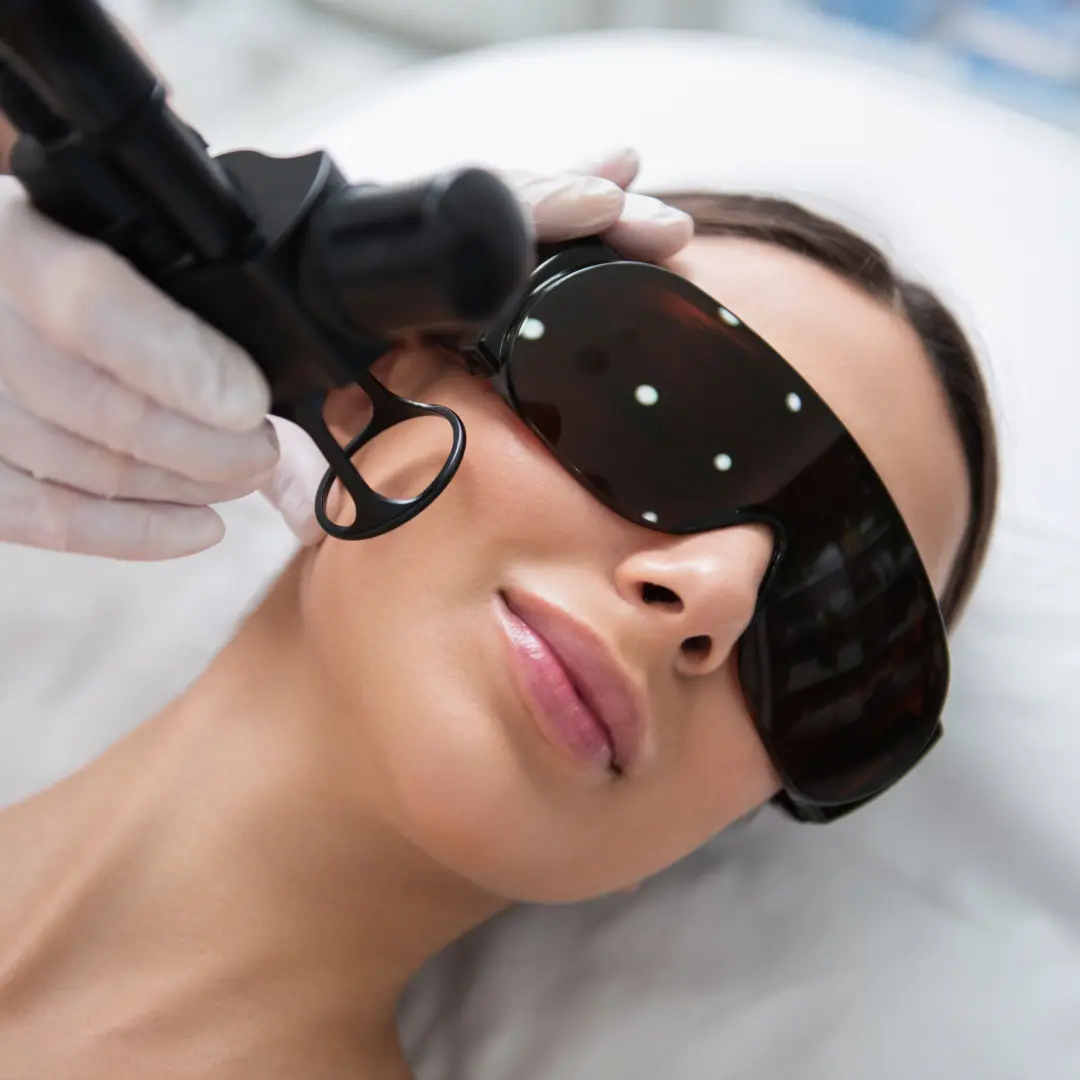 Laser Skin Resurfacing in Manitowoc, WI