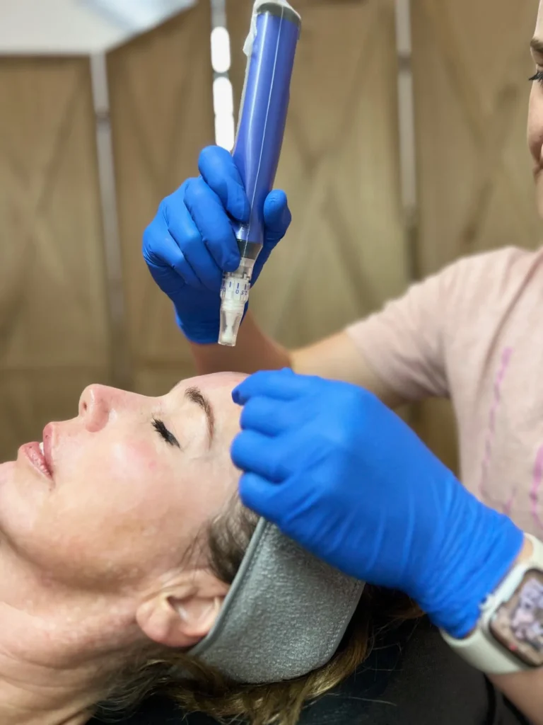 SkinPen Microneedling in Manitowoc, WI